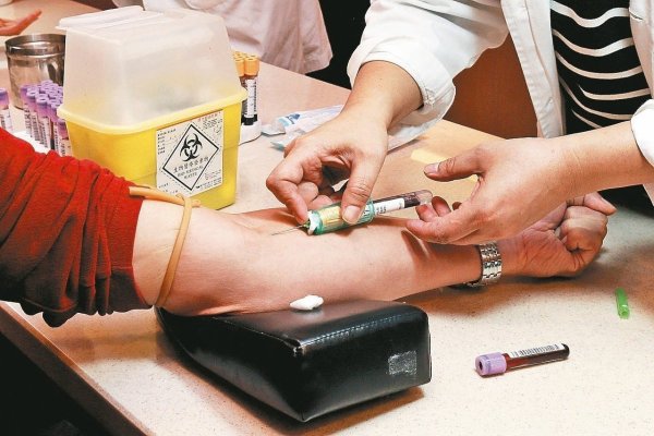 Do I need a health check? It is best to do this 