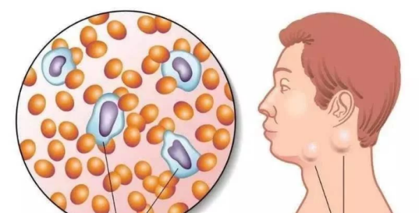 Be careful when petting a cat! A 9-year-old girl contracted a strange disease while playing with cats. Doctors said it was serious and could lead to blindness.